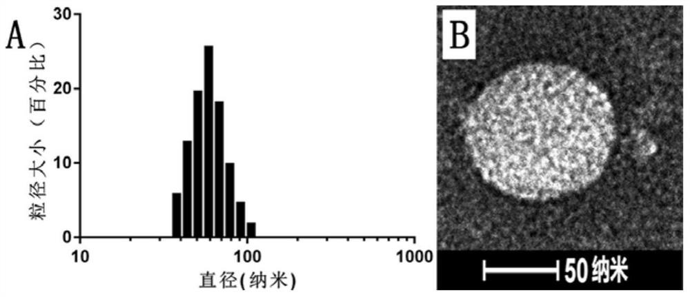 Light-controlled temperature-sensitive liposome and its preparation method and application