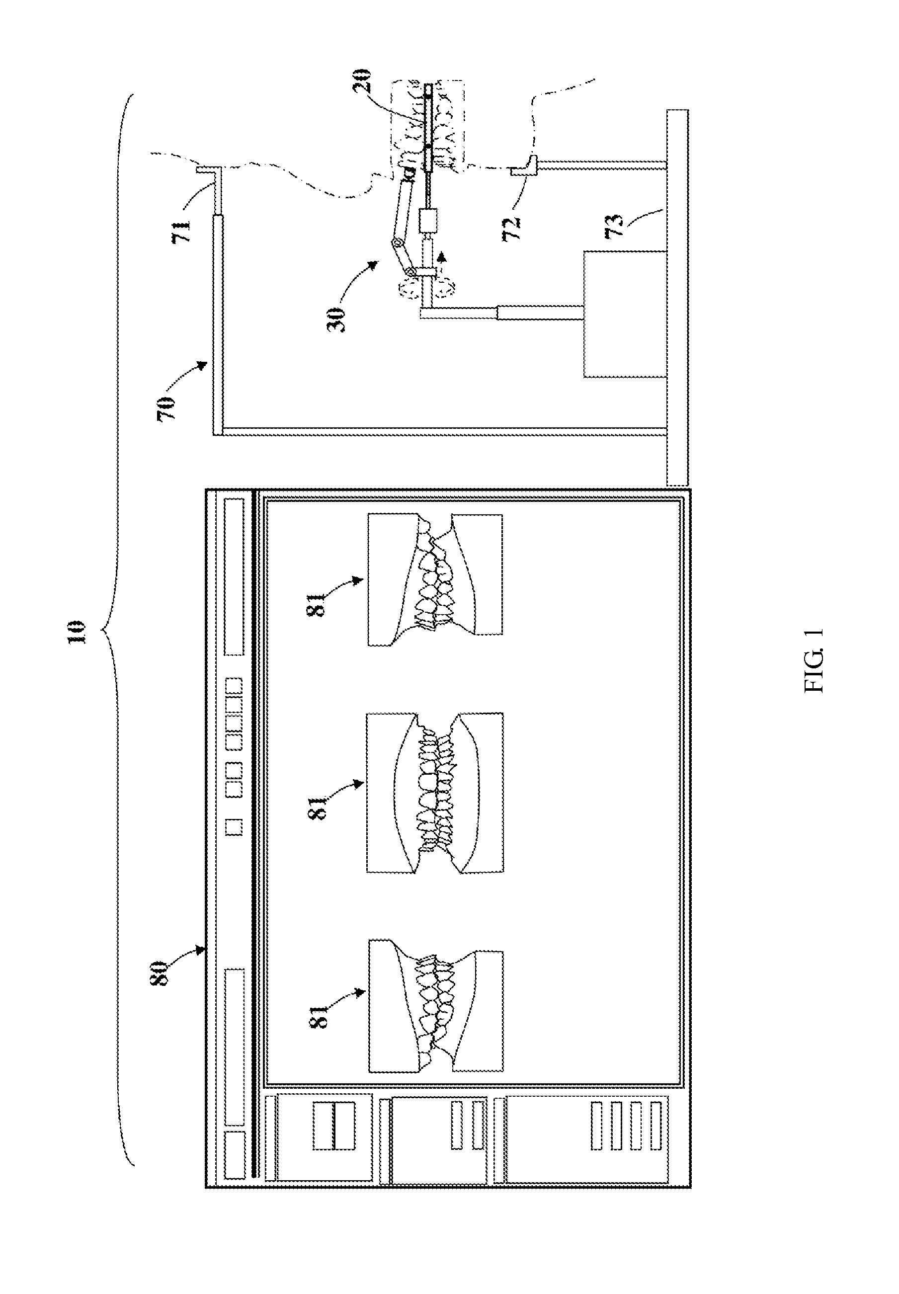 Automated orthodontic bracket positioning system and method