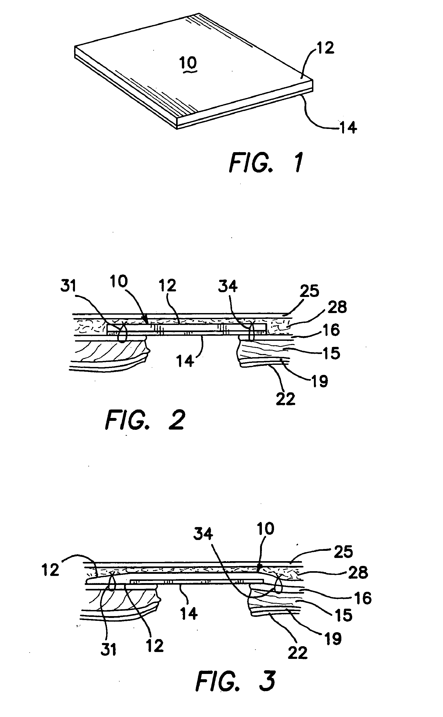 Tissue-treating implantable compositions