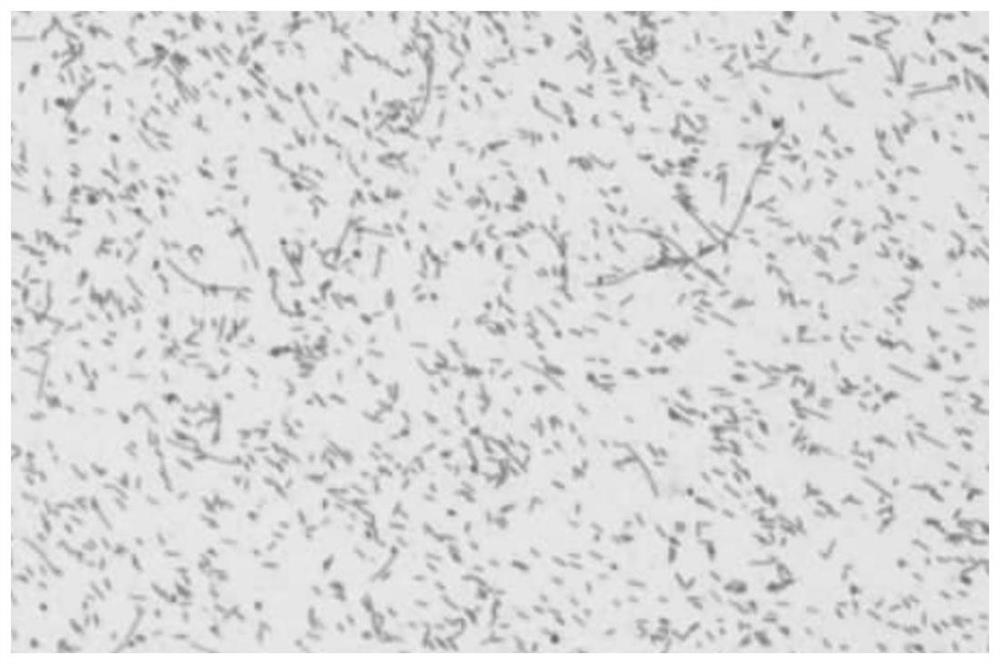 A method for isolating and culturing Helicobacter pylori strains