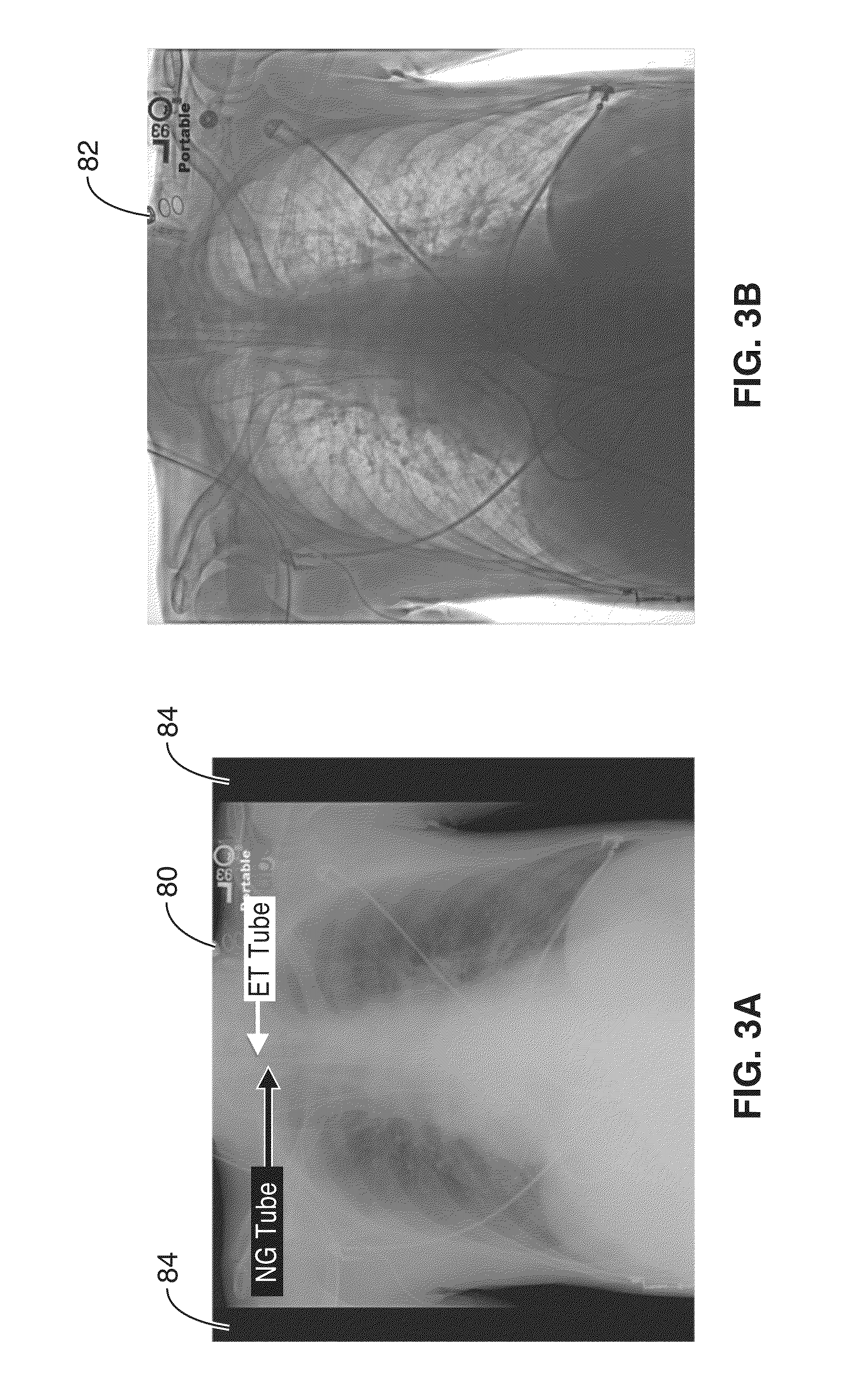 Methods and apparatus for computer-aided radiological detection and imaging