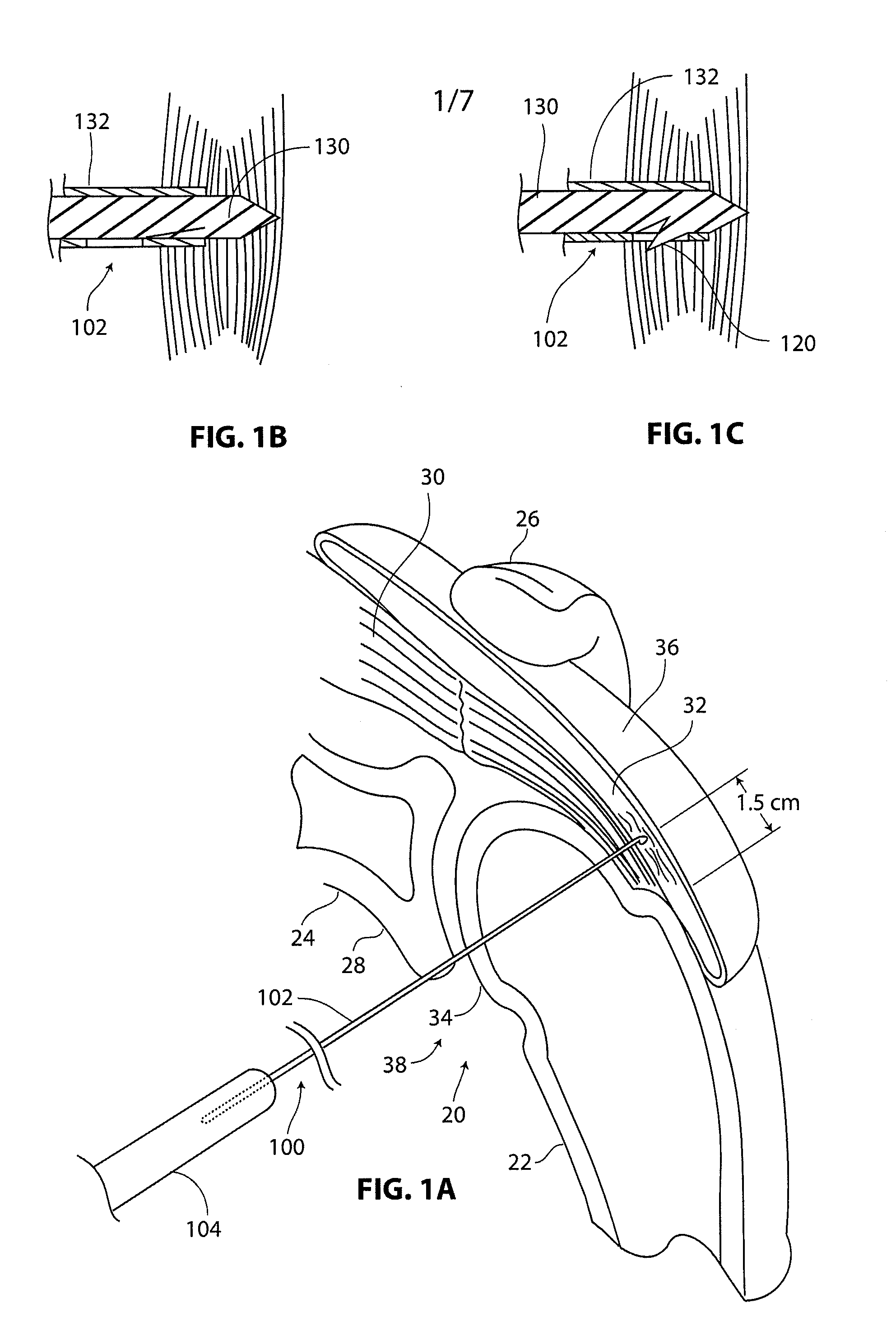 Medical device delivery system and method
