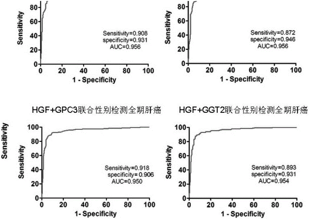 Preparation of single chain antibody of human liver cancer marker and application thereof