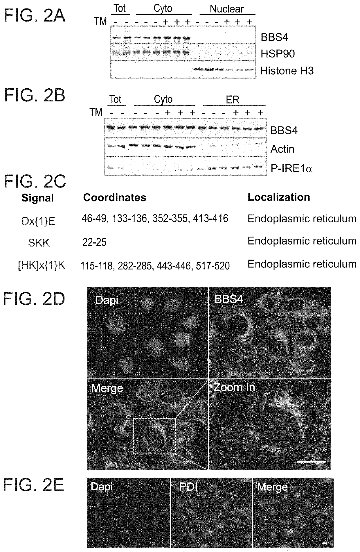 Methods of treating diseases associated with cells exhibiting er stress or with neural tissue damage