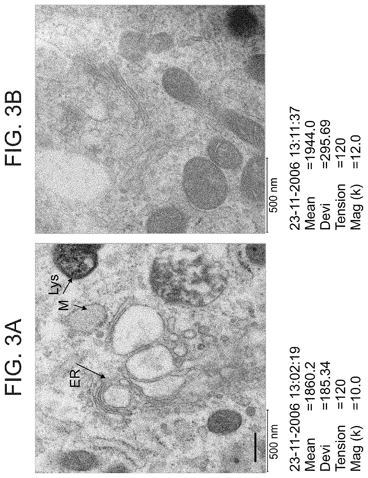 Methods of treating diseases associated with cells exhibiting er stress or with neural tissue damage