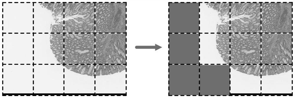 Lung pathological image classification and segmentation method based on deep learning