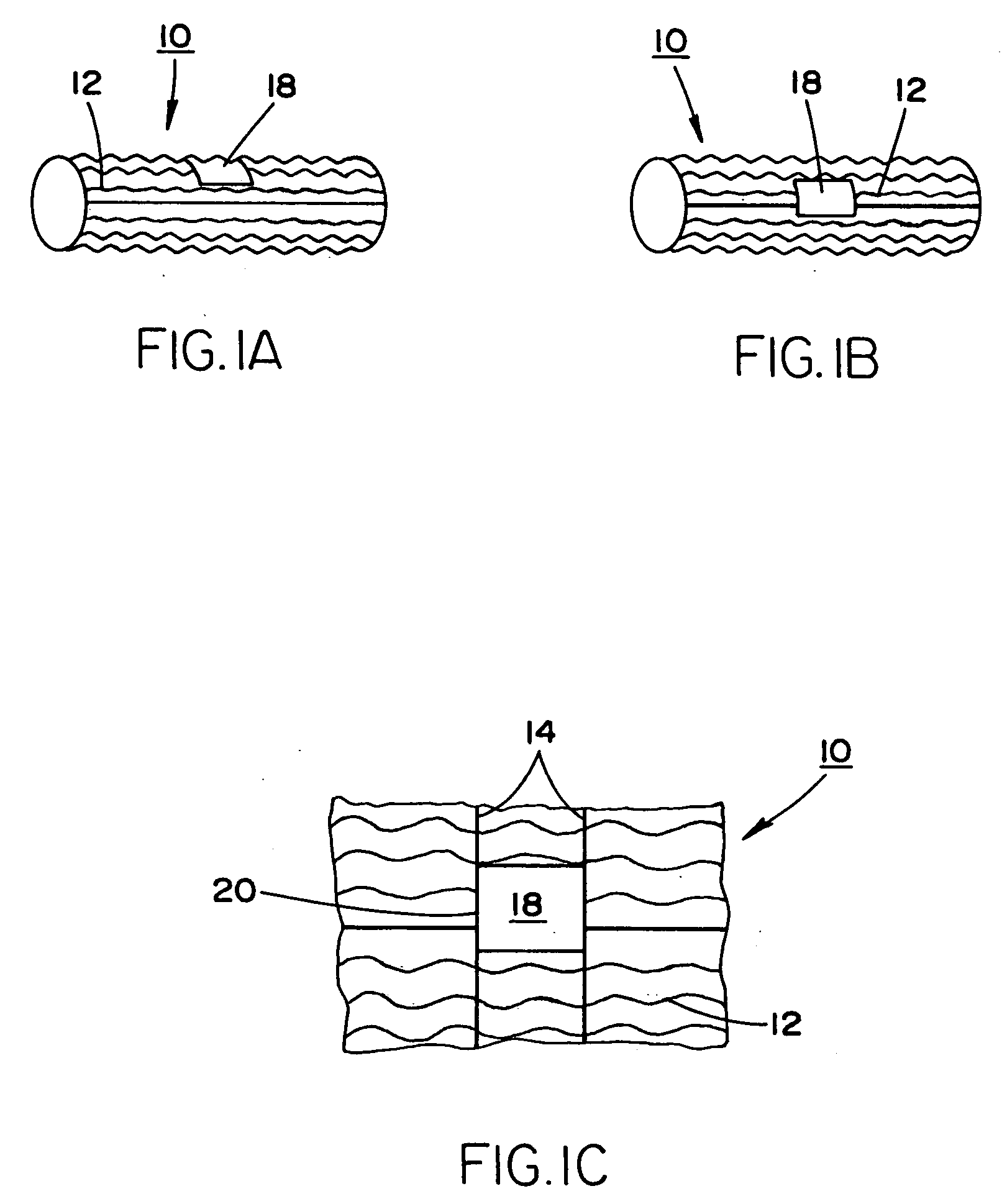 Stent and balloon system for bifurcated vessels and lesions