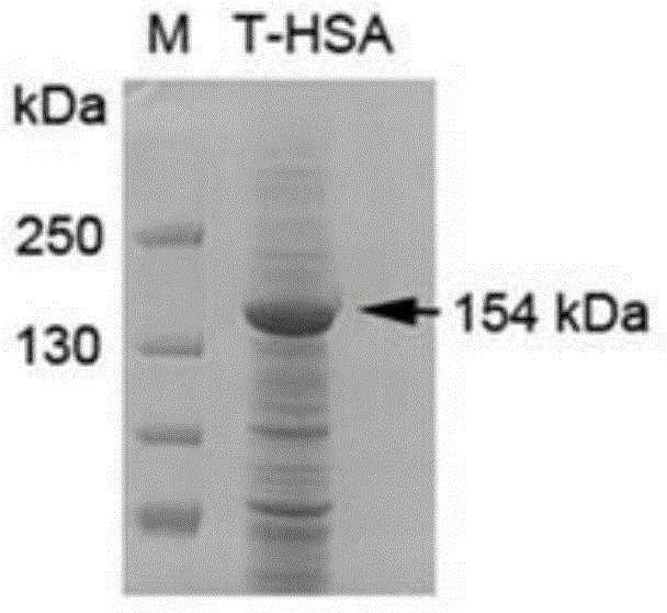 ADAMTS13-MDTCS fusion protein with function of prolonging half life in vivo and application thereof