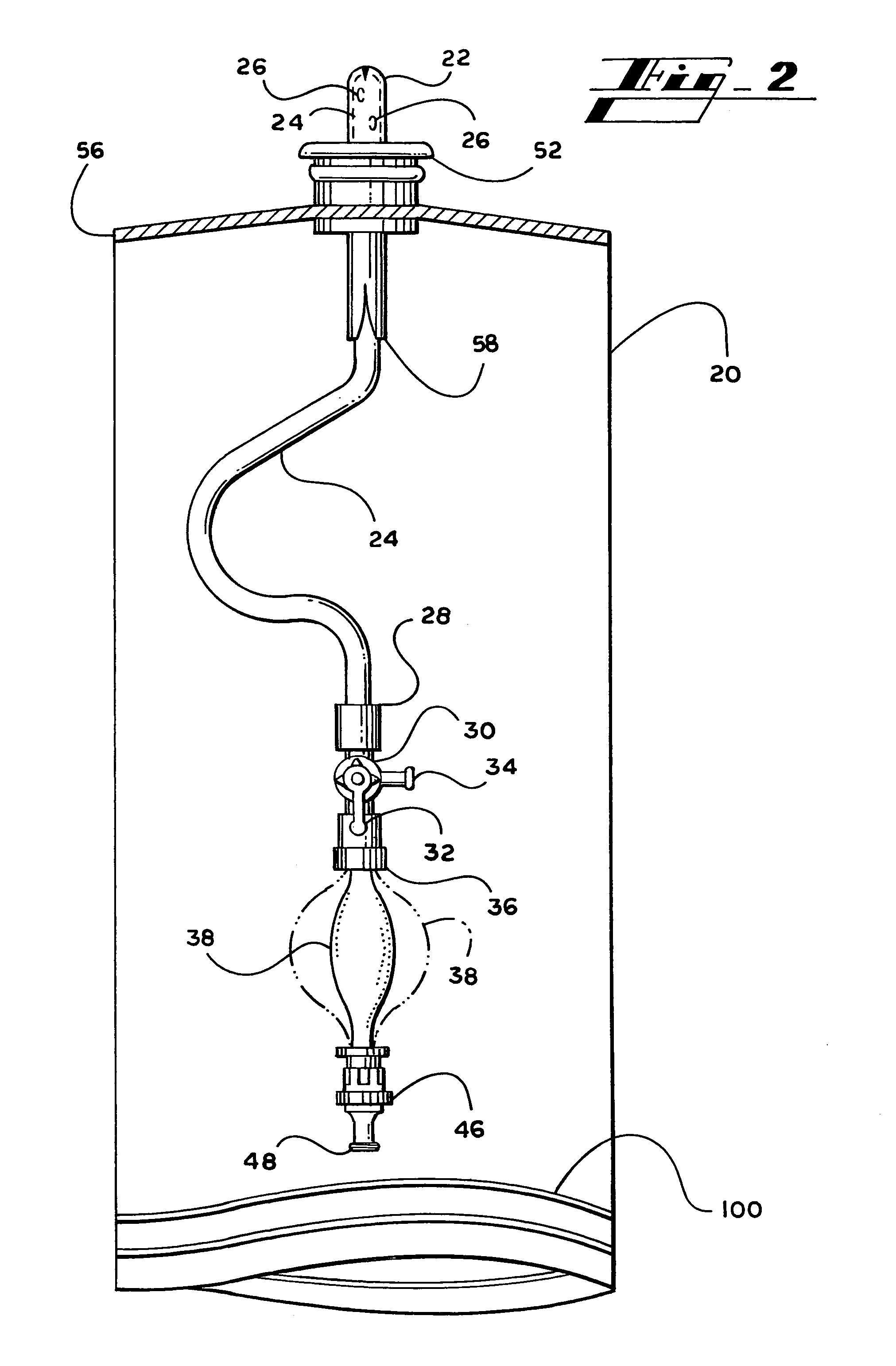 Catheter system and method for delivering medication to the bladder
