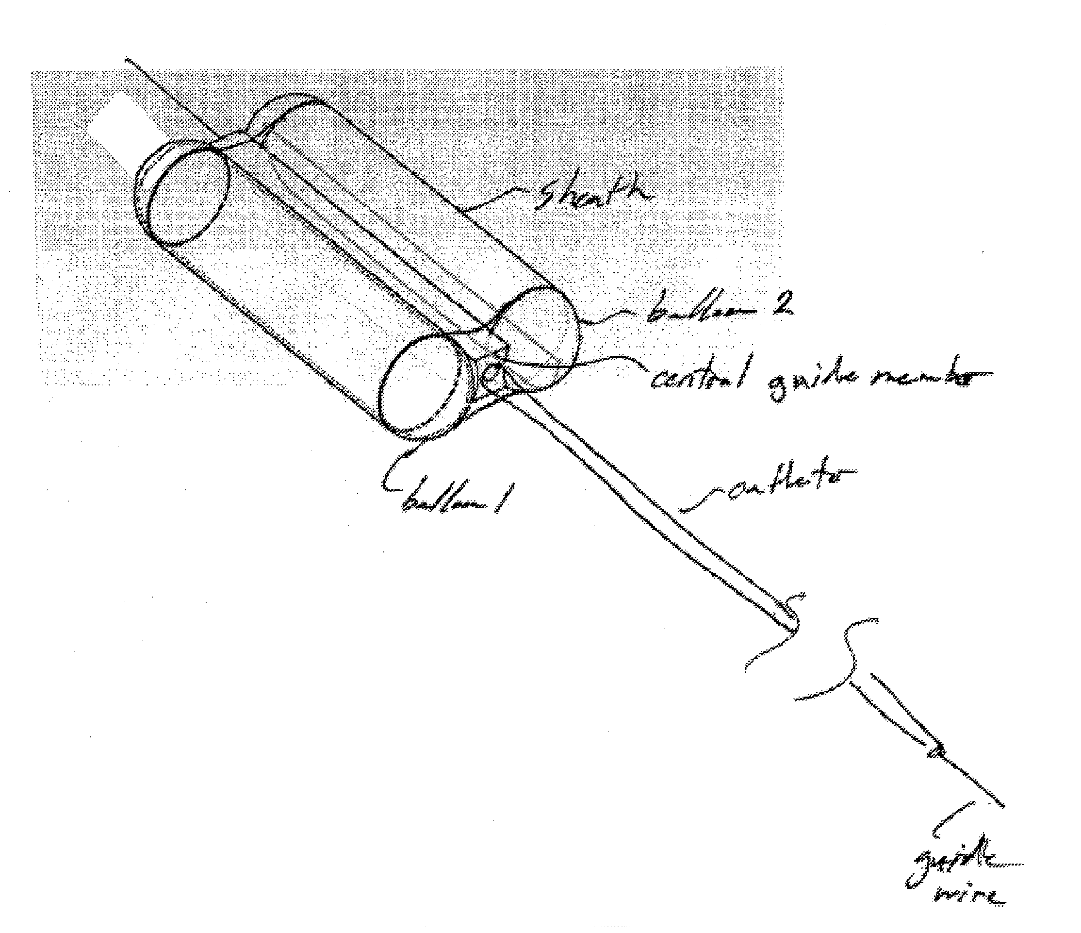 Upper esophageal sphincter dilator