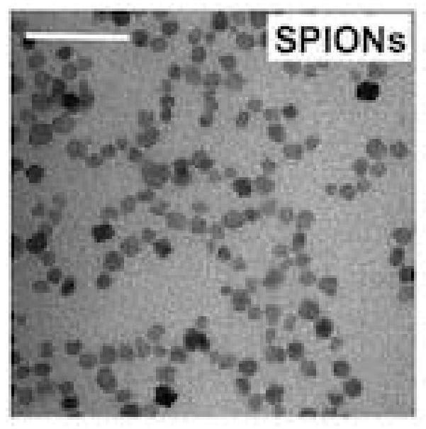 A kind of nuclear magnetic contrast agent with oligomer specificity and its preparation method and application