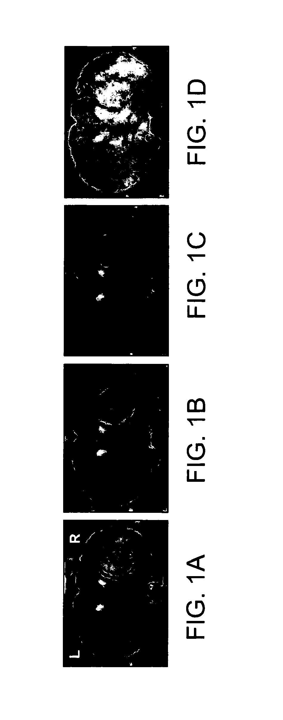 Functionalized Magnetic Nanoparticles and Methods of Use Thereof