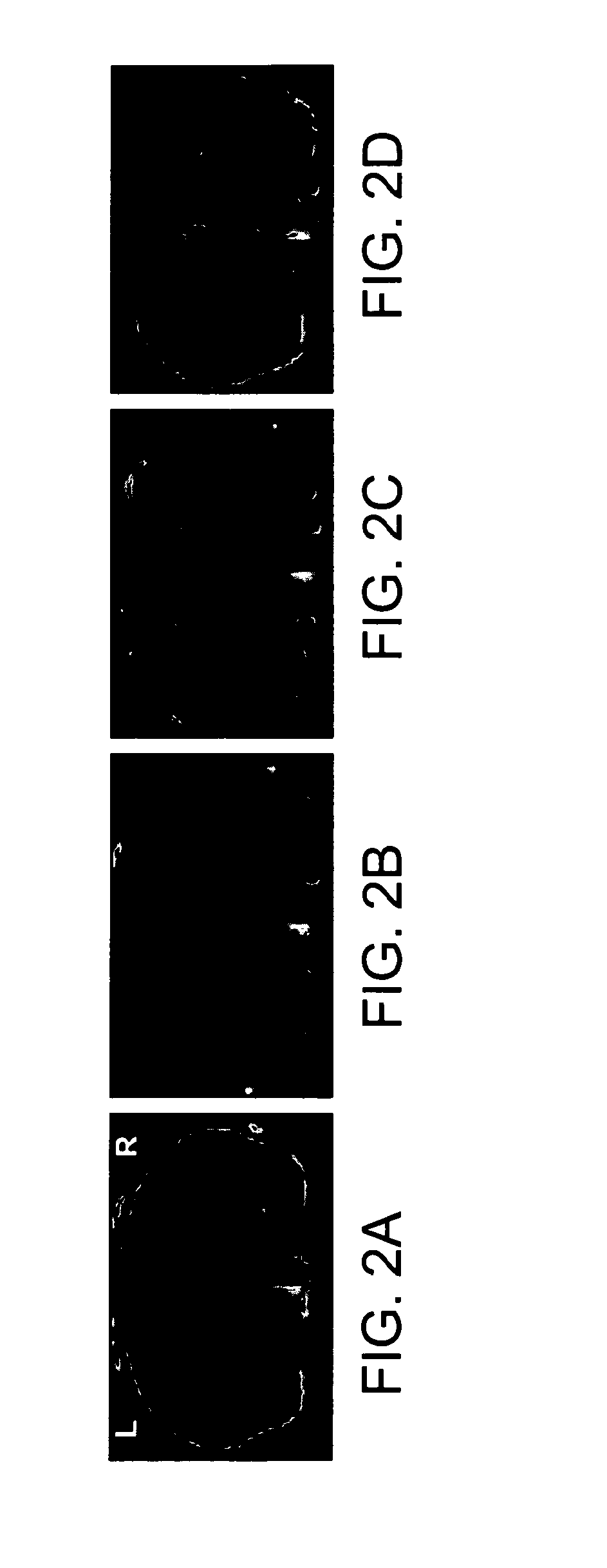 Functionalized Magnetic Nanoparticles and Methods of Use Thereof