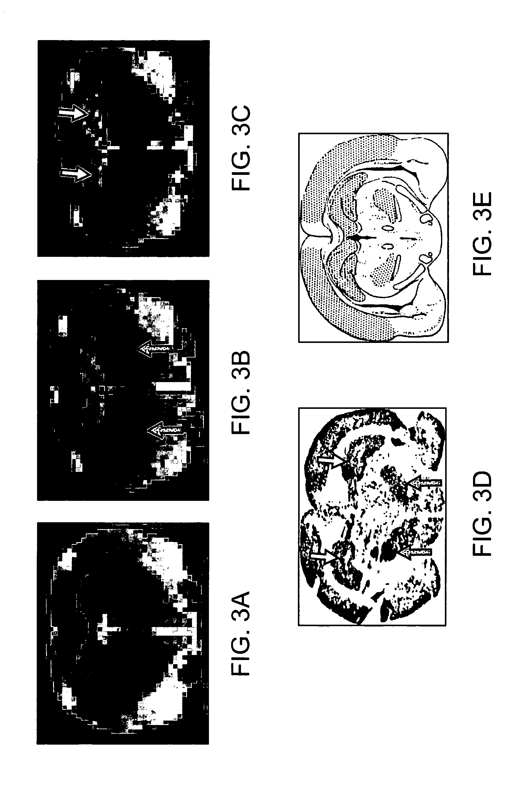 Functionalized Magnetic Nanoparticles and Methods of Use Thereof