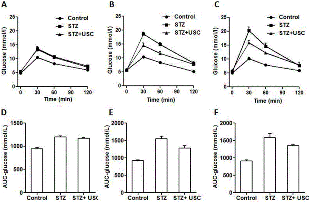 Application of urine stem cells in preparation of drug for improving glucose metabolism of mouse