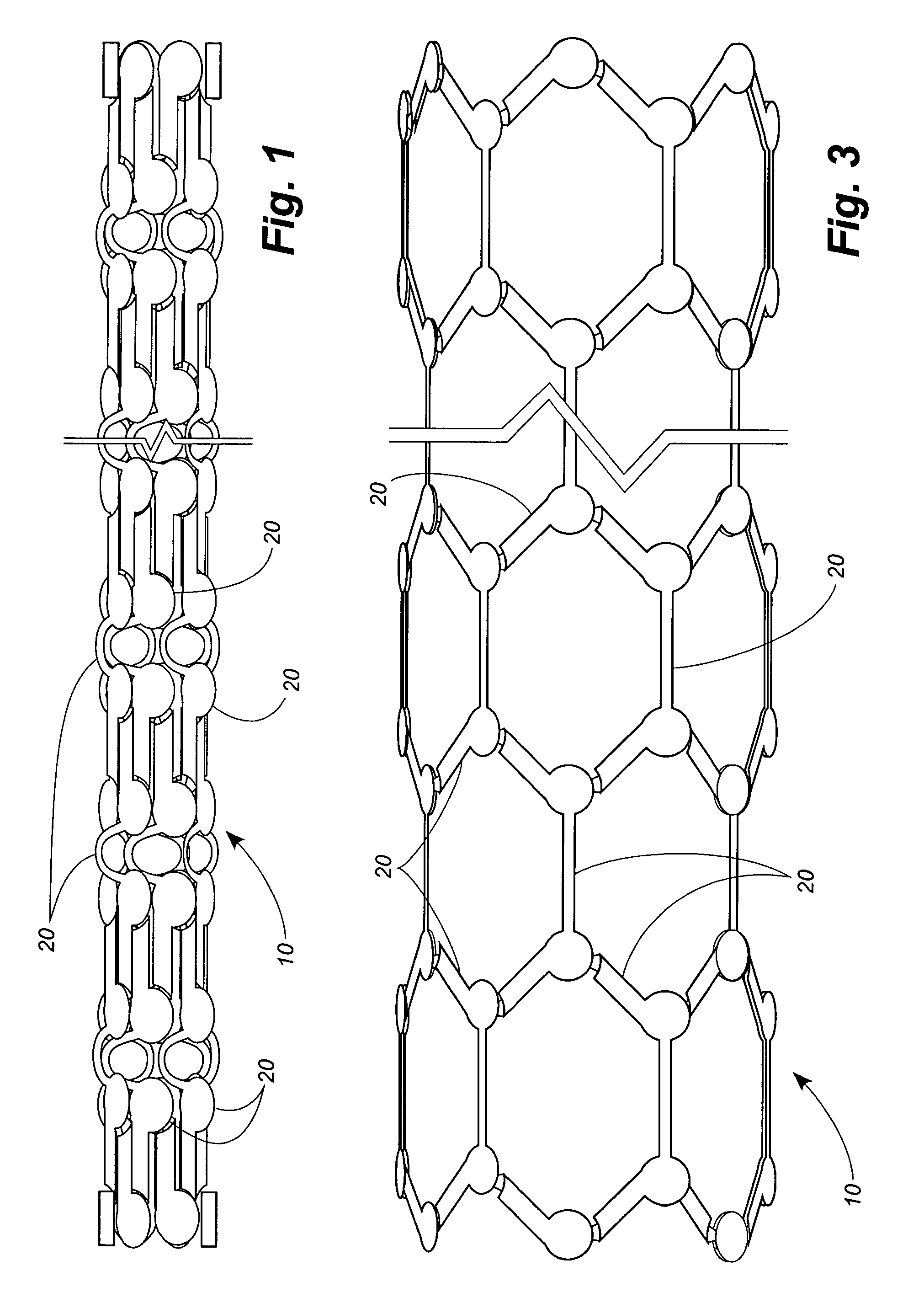 Stent with micro-latching hinge joints
