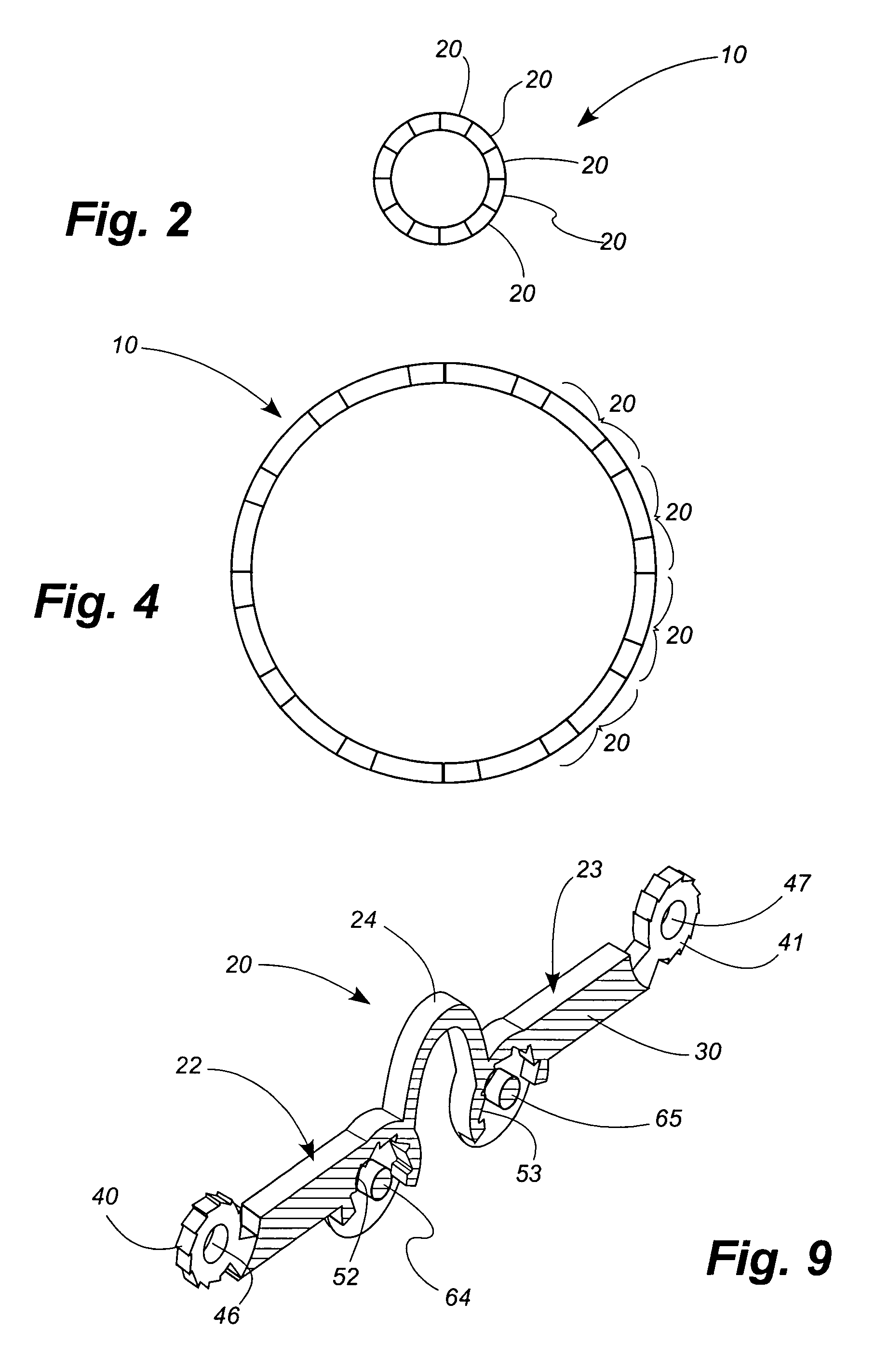 Stent with micro-latching hinge joints