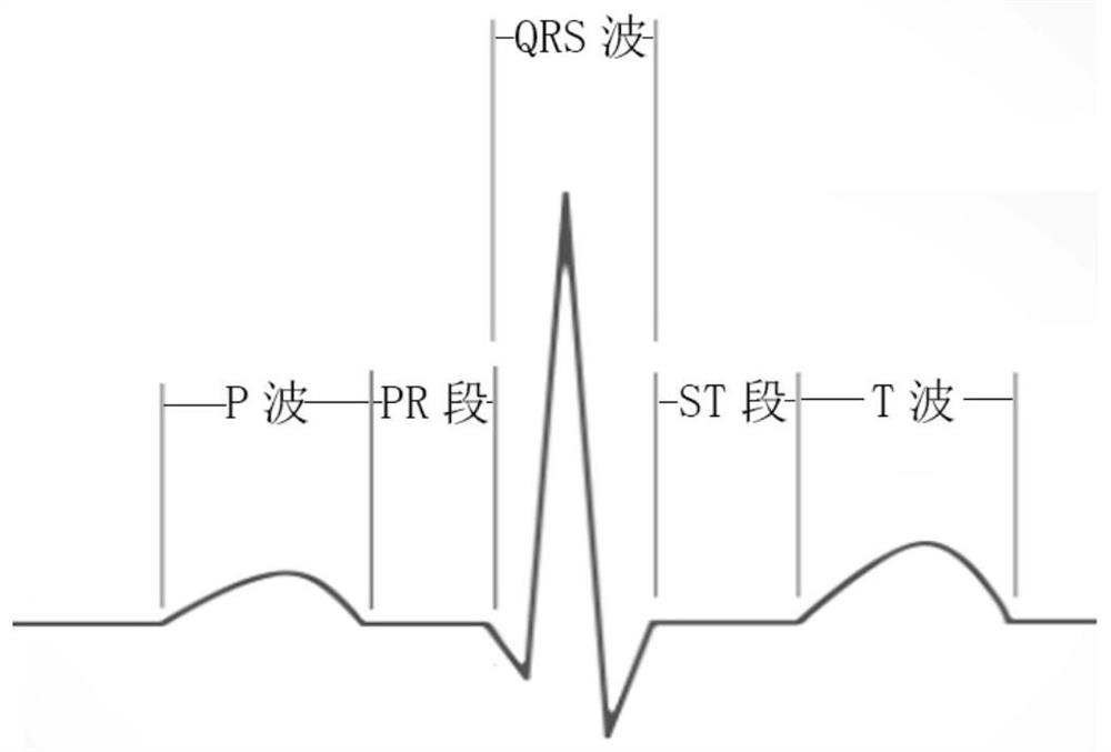 Embedded child electrocardiogram monitoring equipment and system