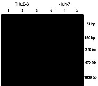 Biological compound for treating cancer, and preparation method and application of biological compound