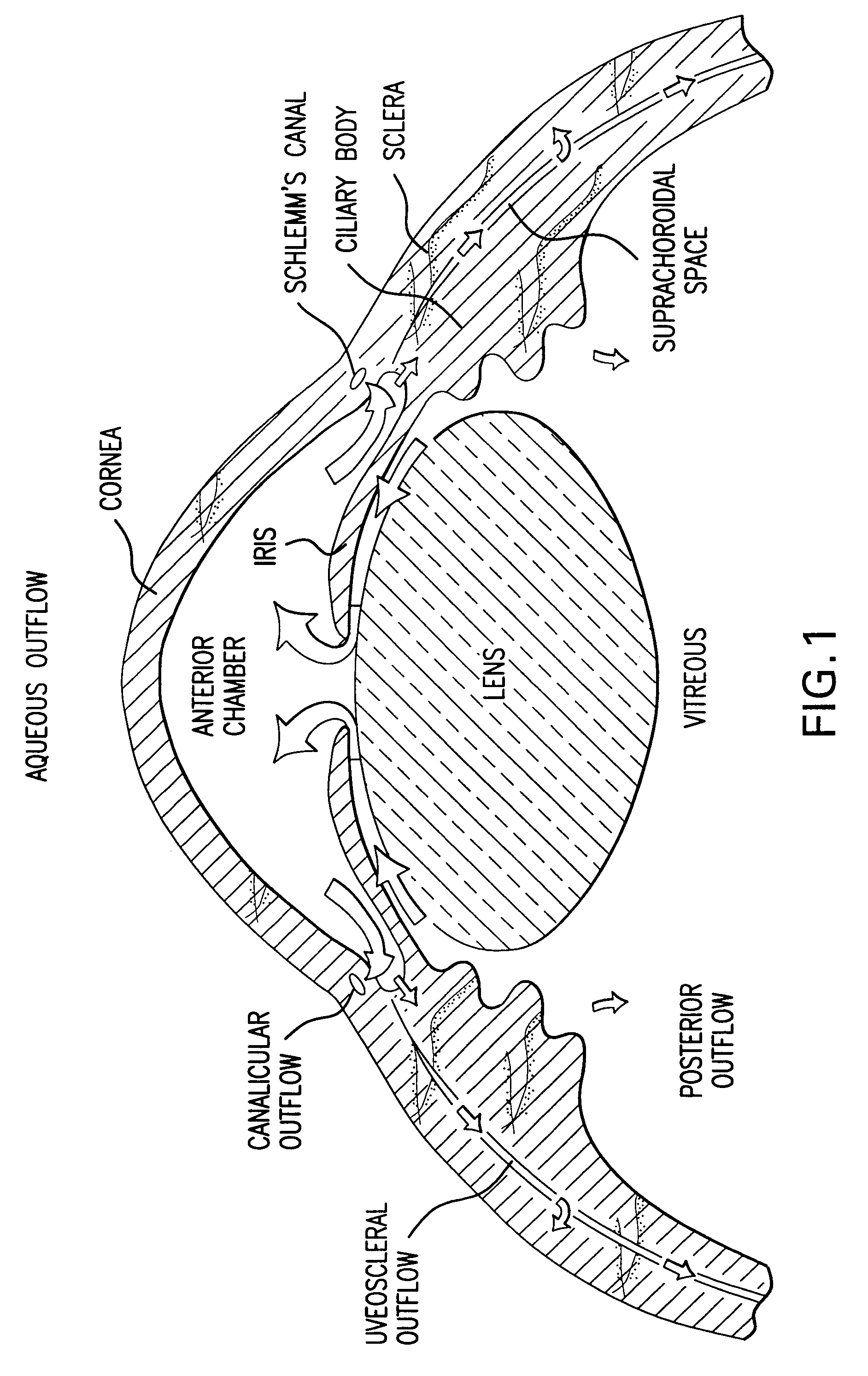 Uveoscleral drainage device