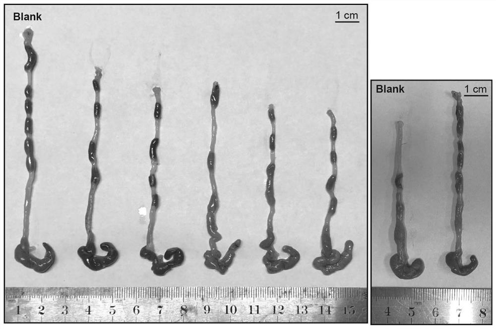 Application of isoliensinine in preparation of medicine for preventing or treating colitis