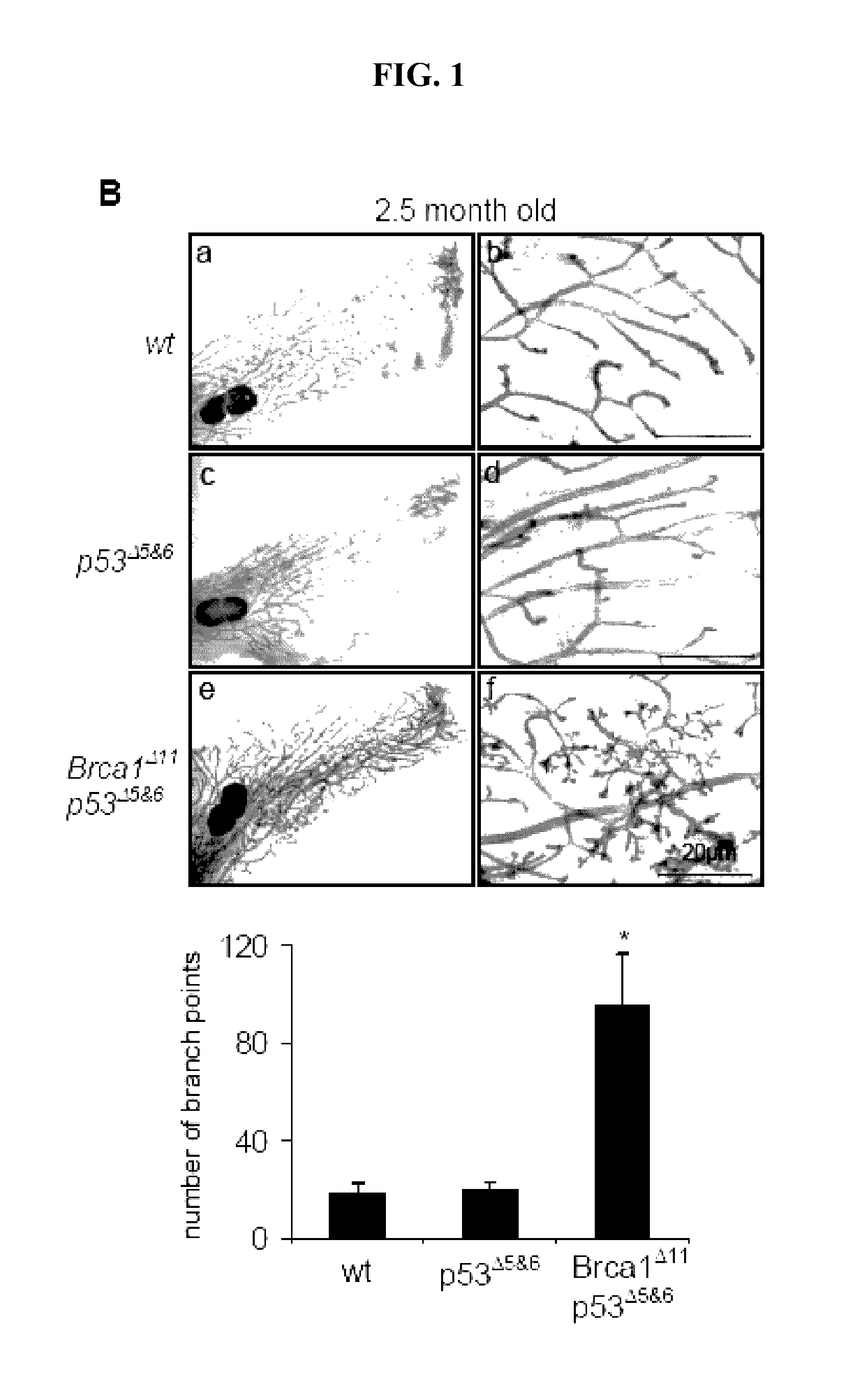 Methods and compositions for cancer prevention and treatment