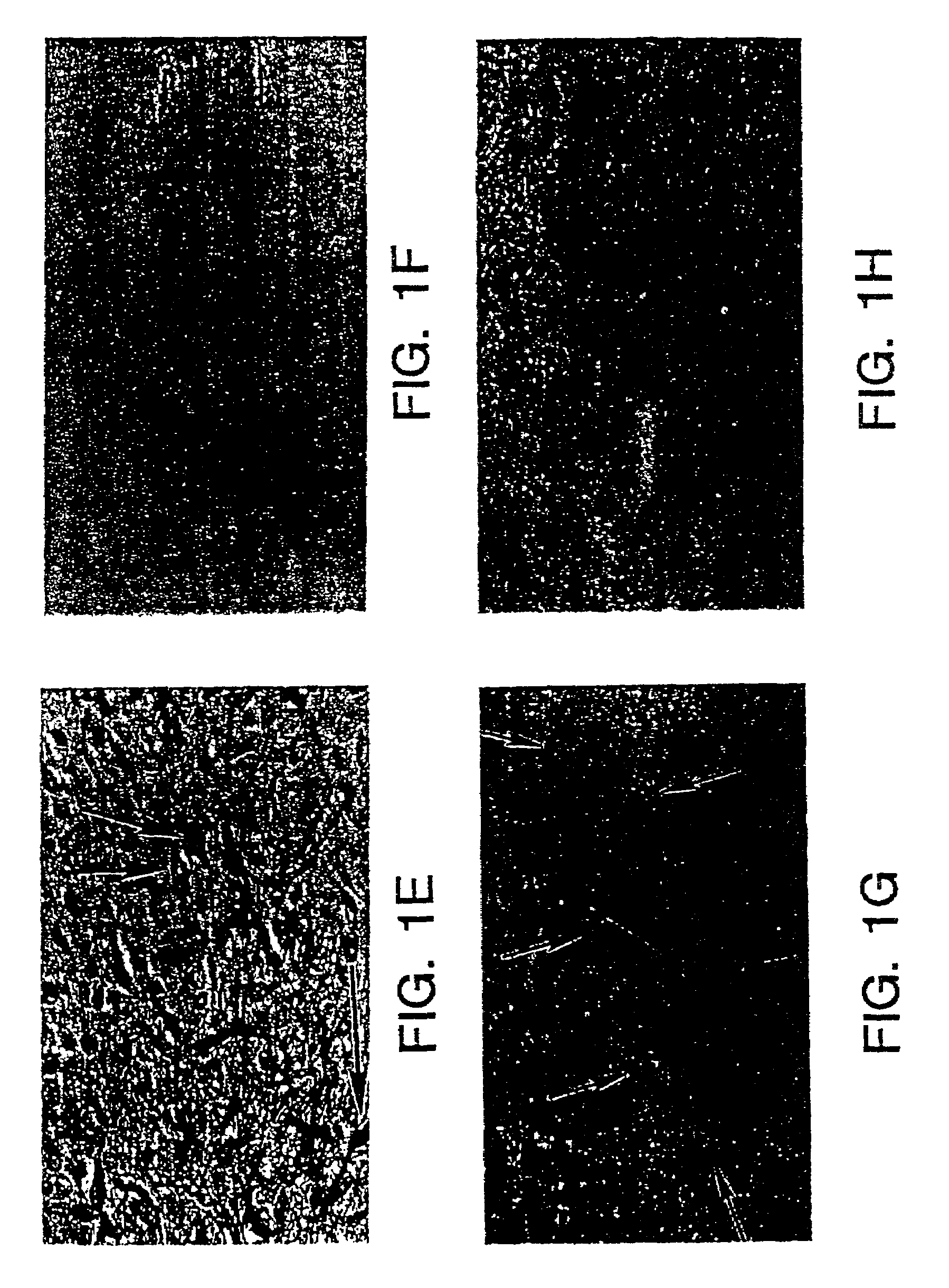 Compositions and methods for producing and using homogenous neuronal cell transplants