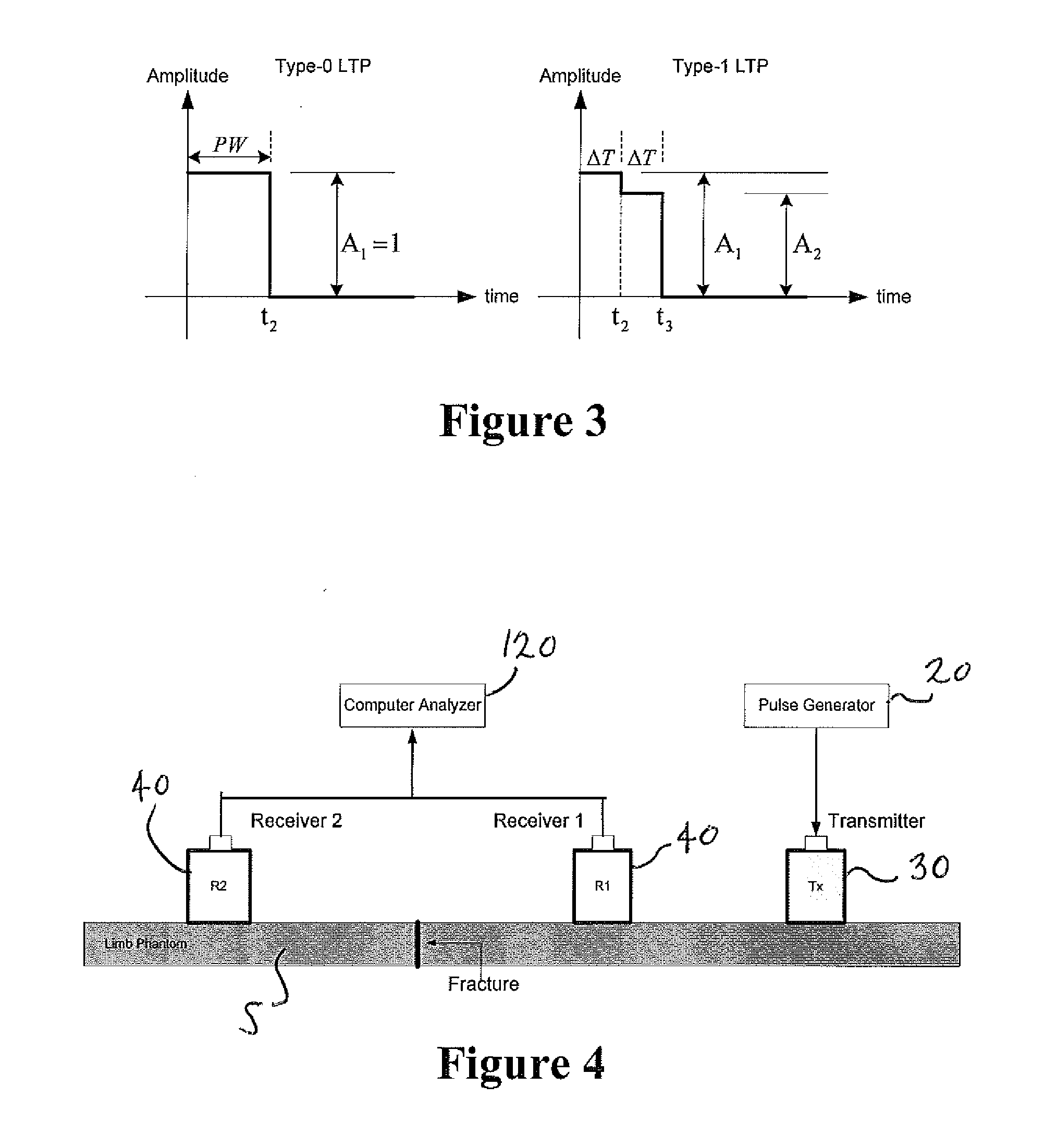 System and method for ultrasound analysis of biological structures