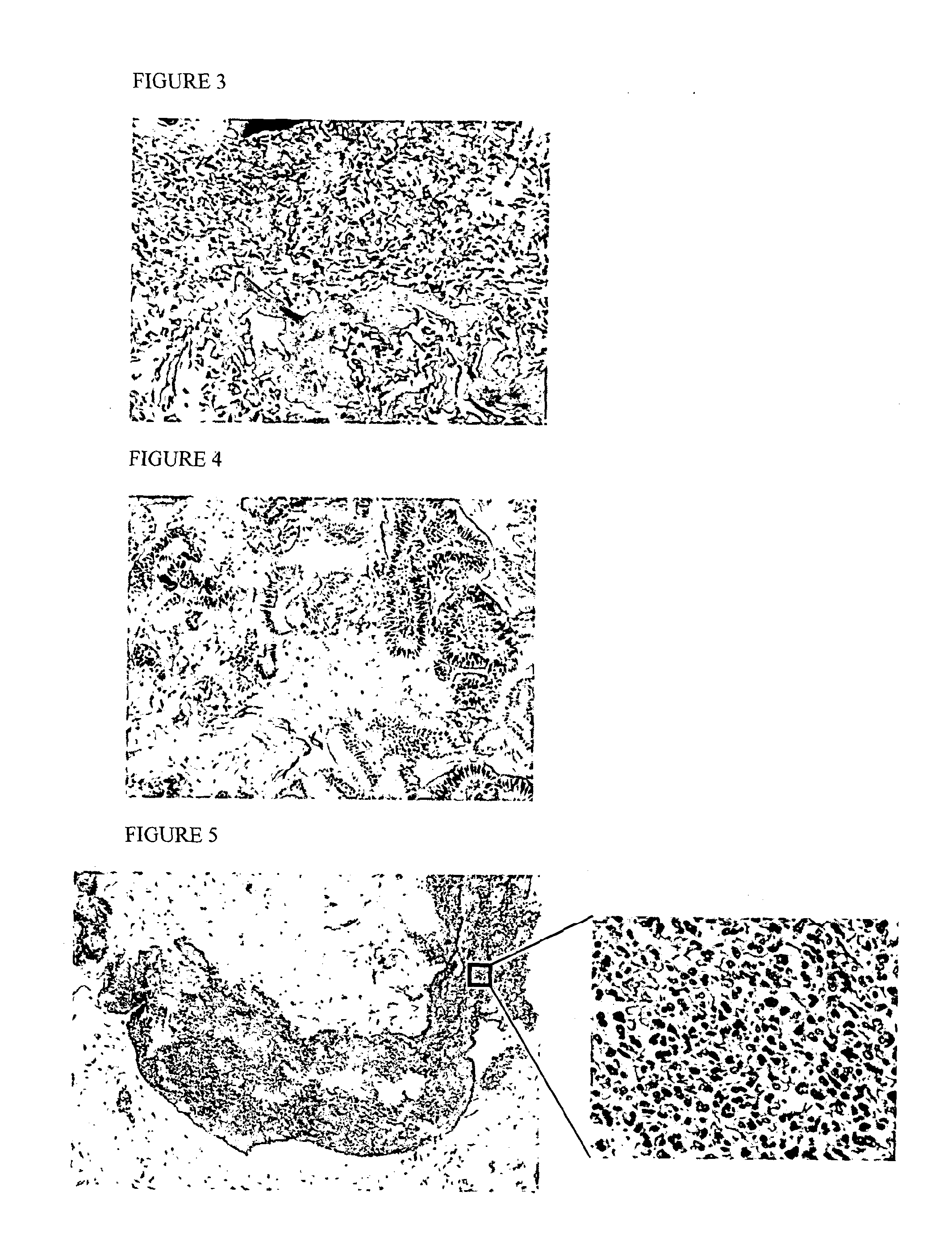 Methods for detecting of benign conditions