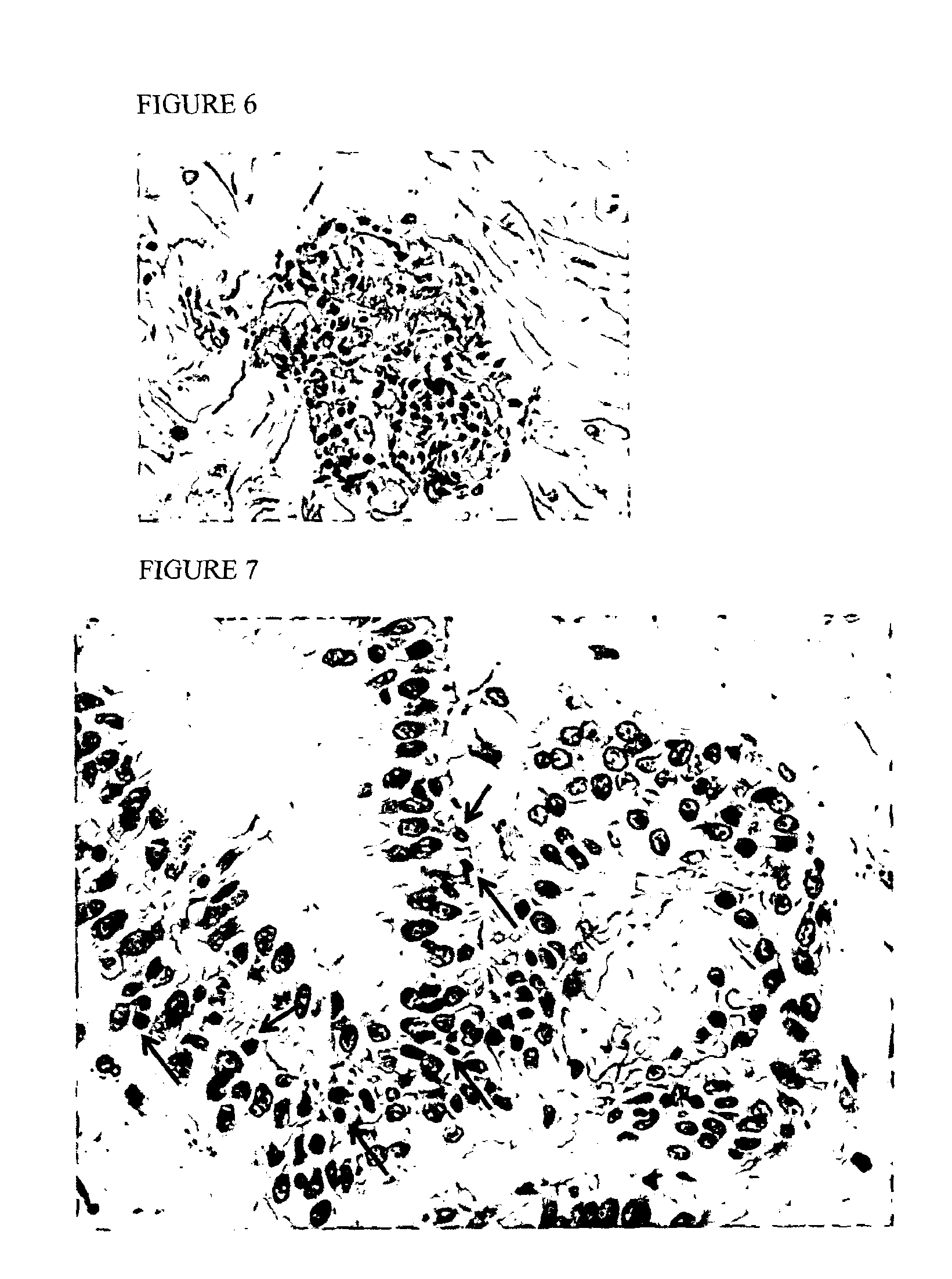 Methods for detecting of benign conditions