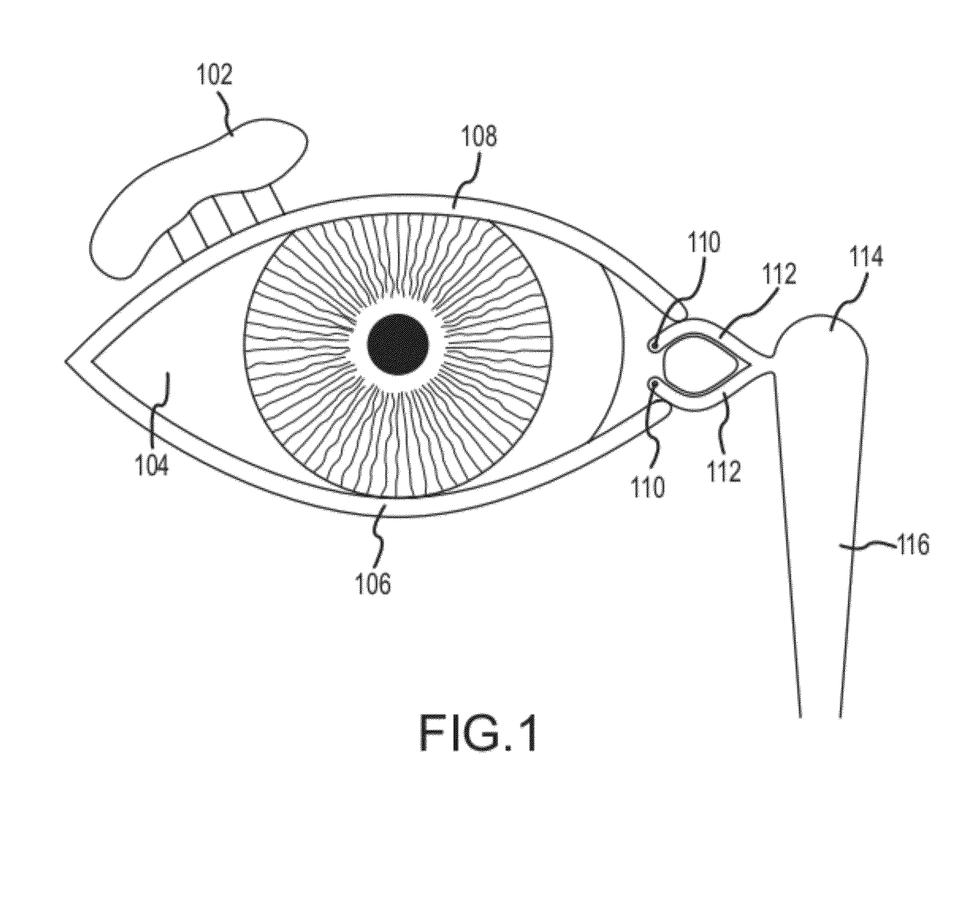 Implant device, tool, and methods relating to treatment of paranasal sinuses