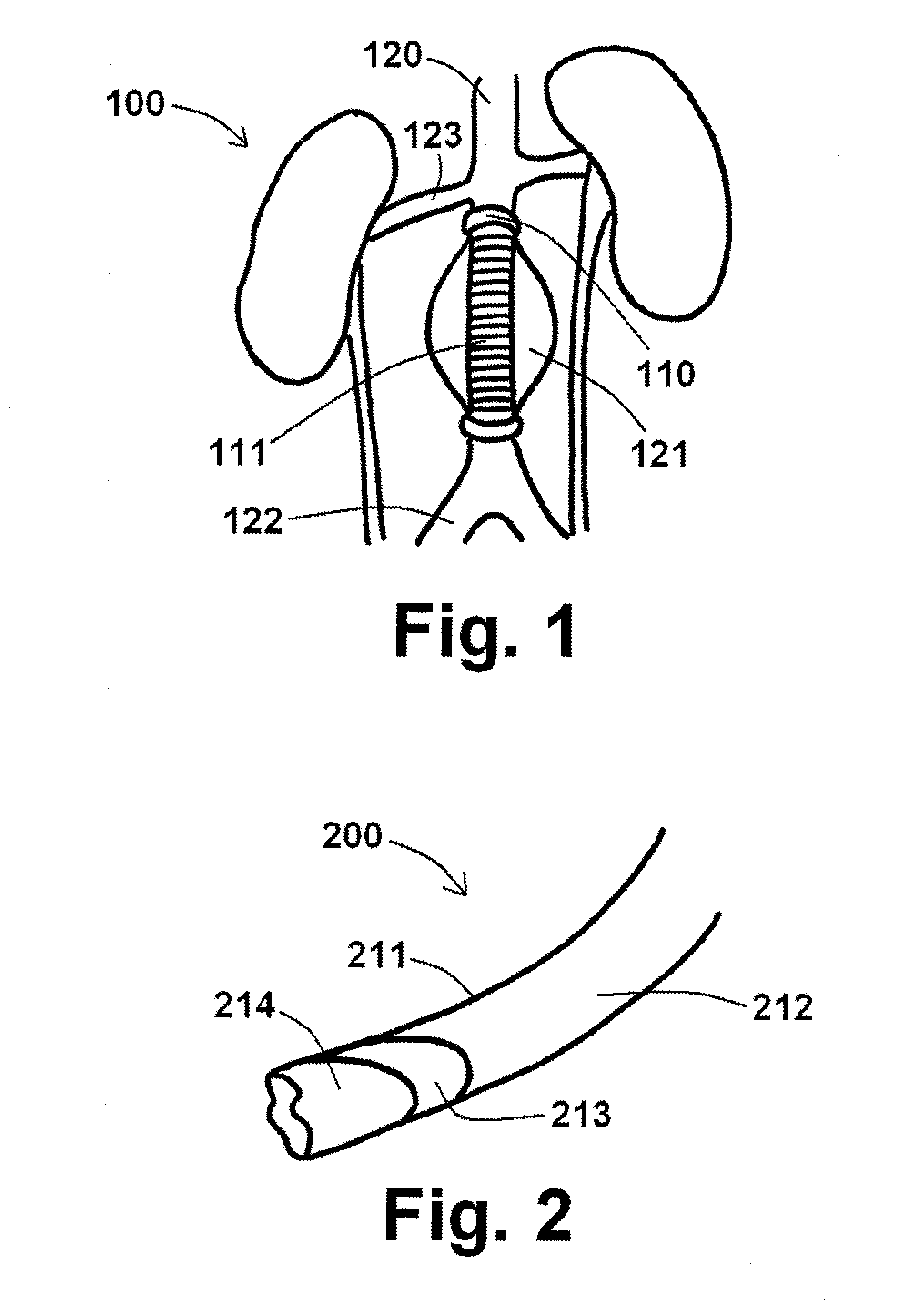 Endograft devices and methods for using the same