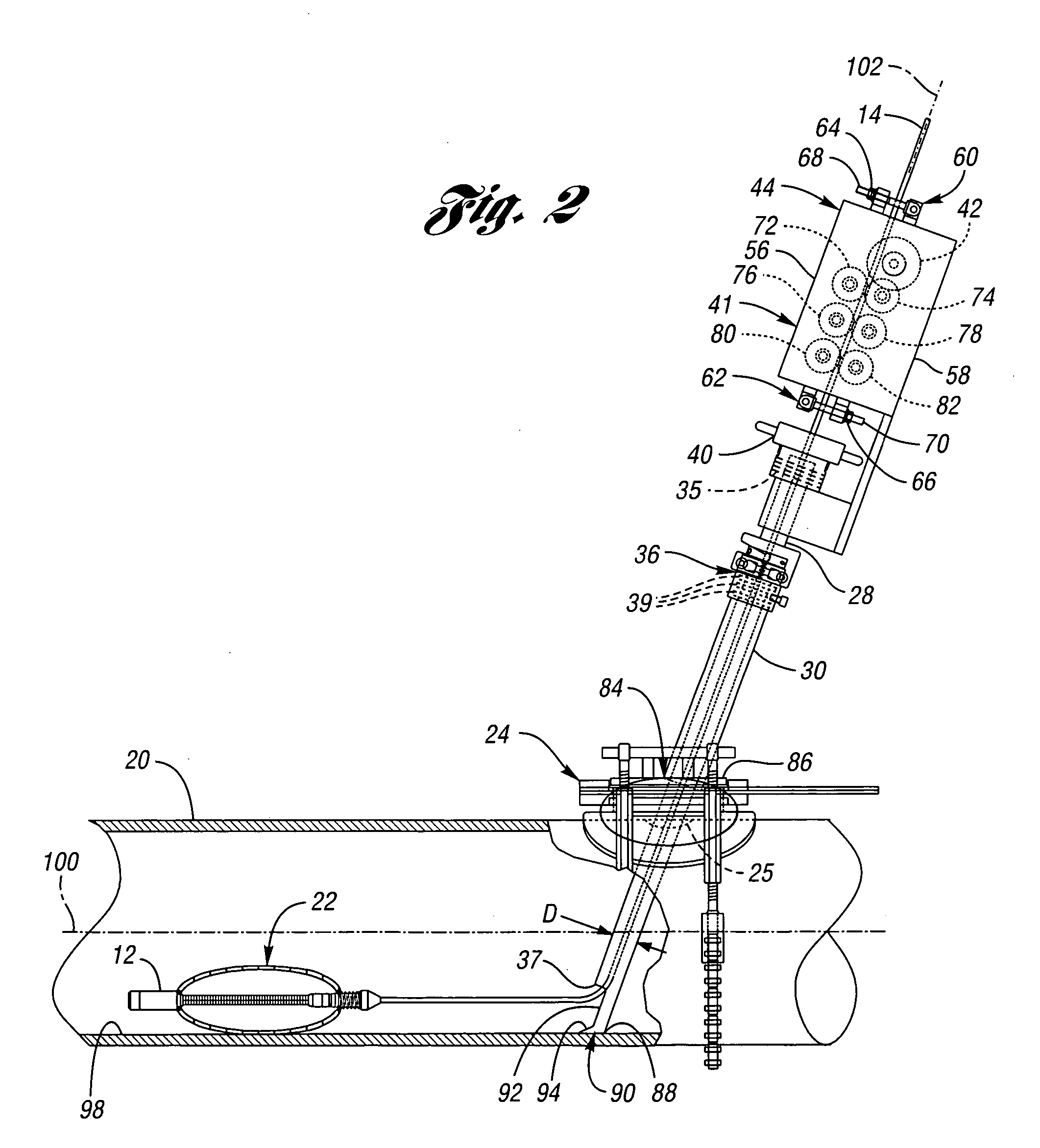 Pipeline inspection system