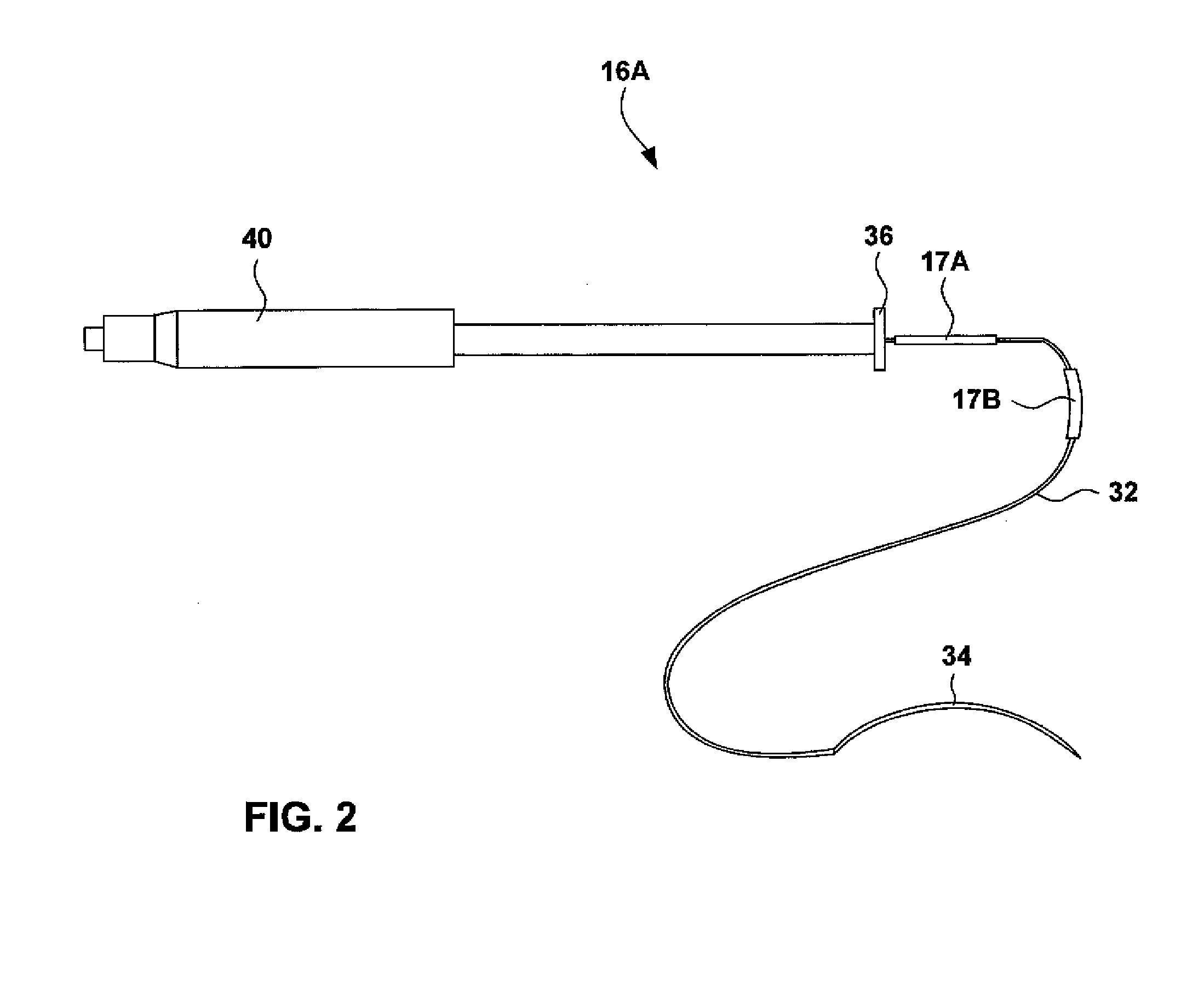 Electrical stimulation of the colon to treat chronic constipation