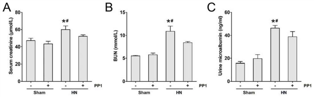 Application of Src inhibitor in preparation of medicine for preventing or treating uric acid nephropathy