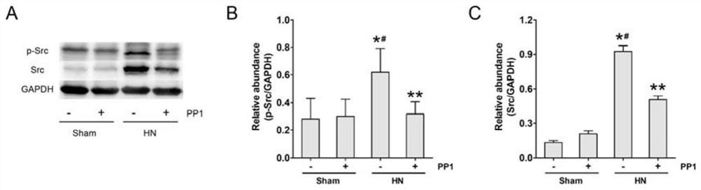 Application of Src inhibitor in preparation of medicine for preventing or treating uric acid nephropathy