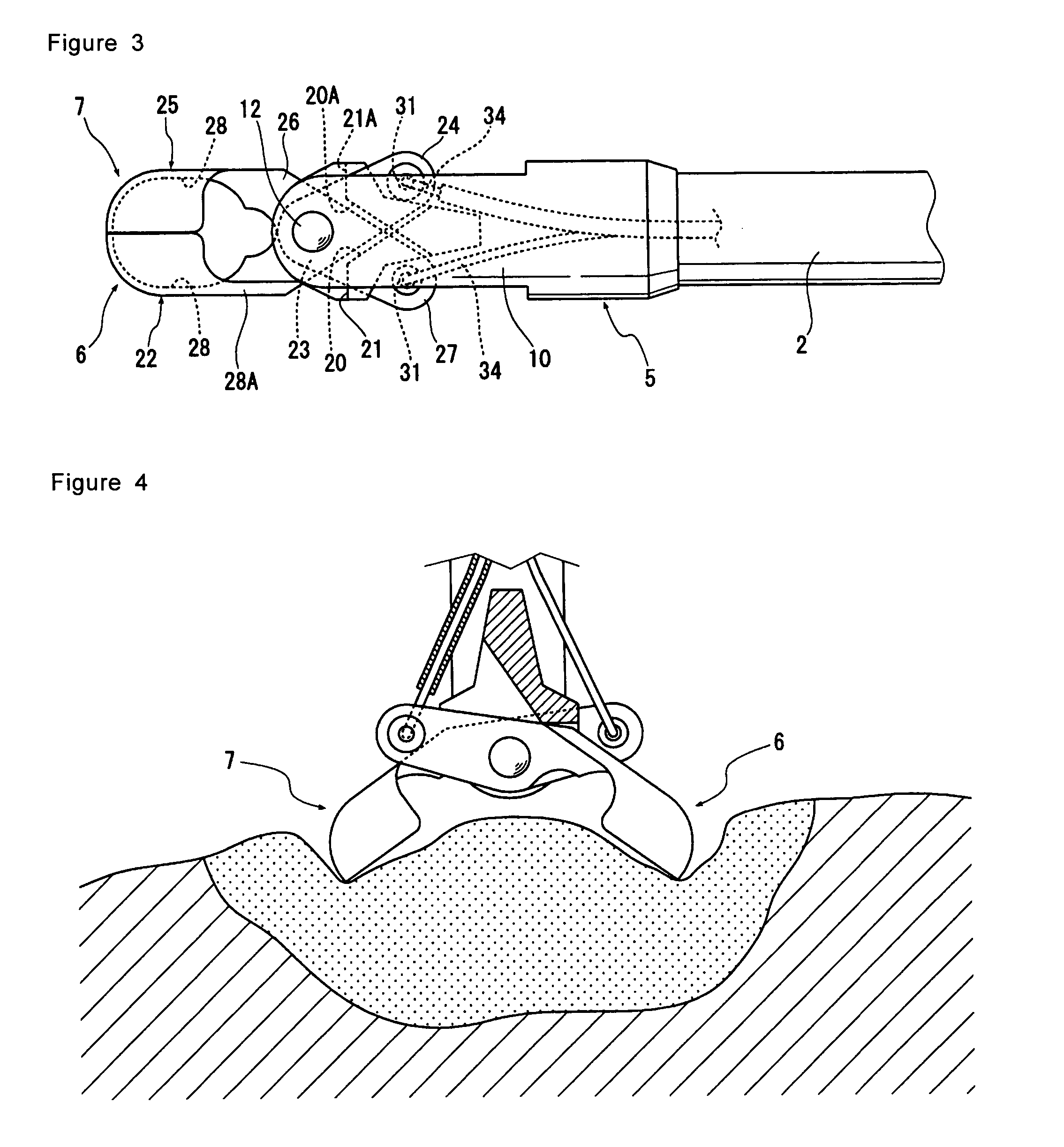 Bipolar high frequency treatment device