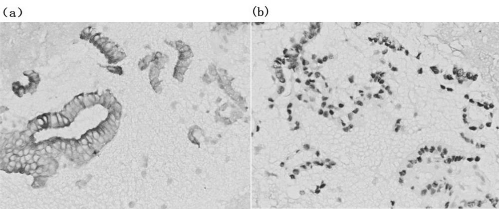 A method for preparing thyroid and breast fine-needle aspiration cell tissue block