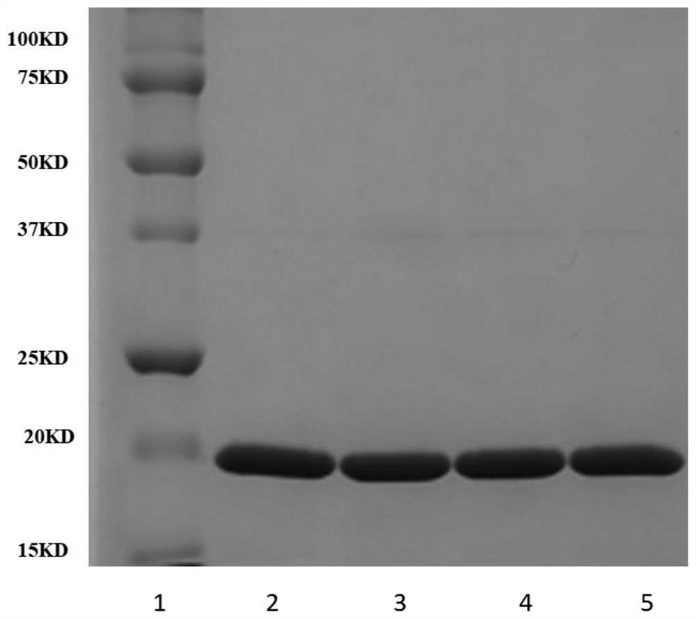 A kind of recombinant retinol binding protein 4 and its preparation method and application