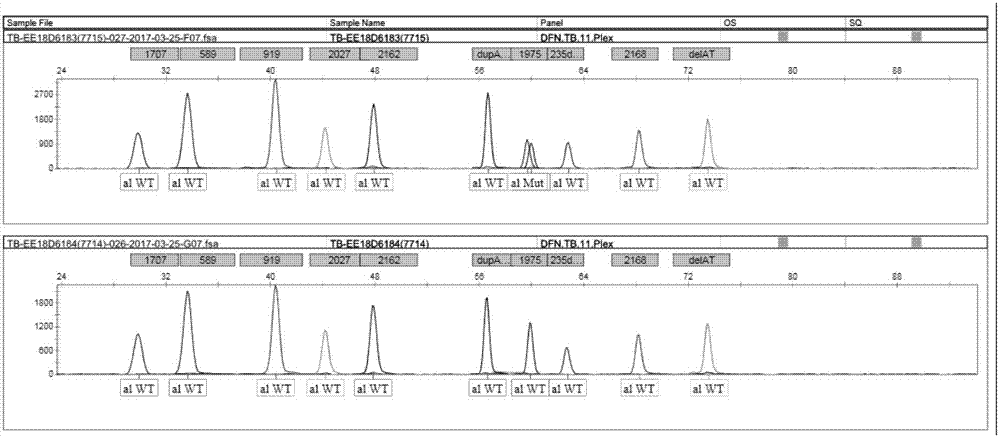 Application of SNaPshot reagent for detecting polymorphism of deafness genes of 22 sites