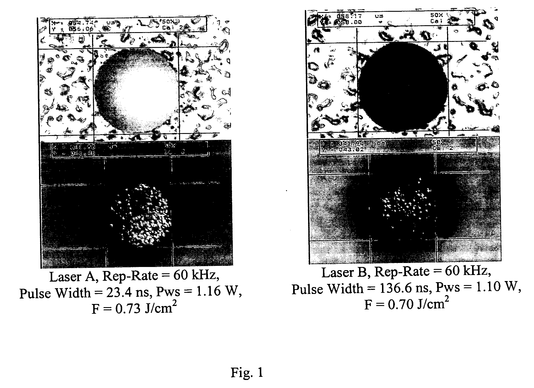 Method of providing consistent quality of target material removal by lasers having different output performance characteristics