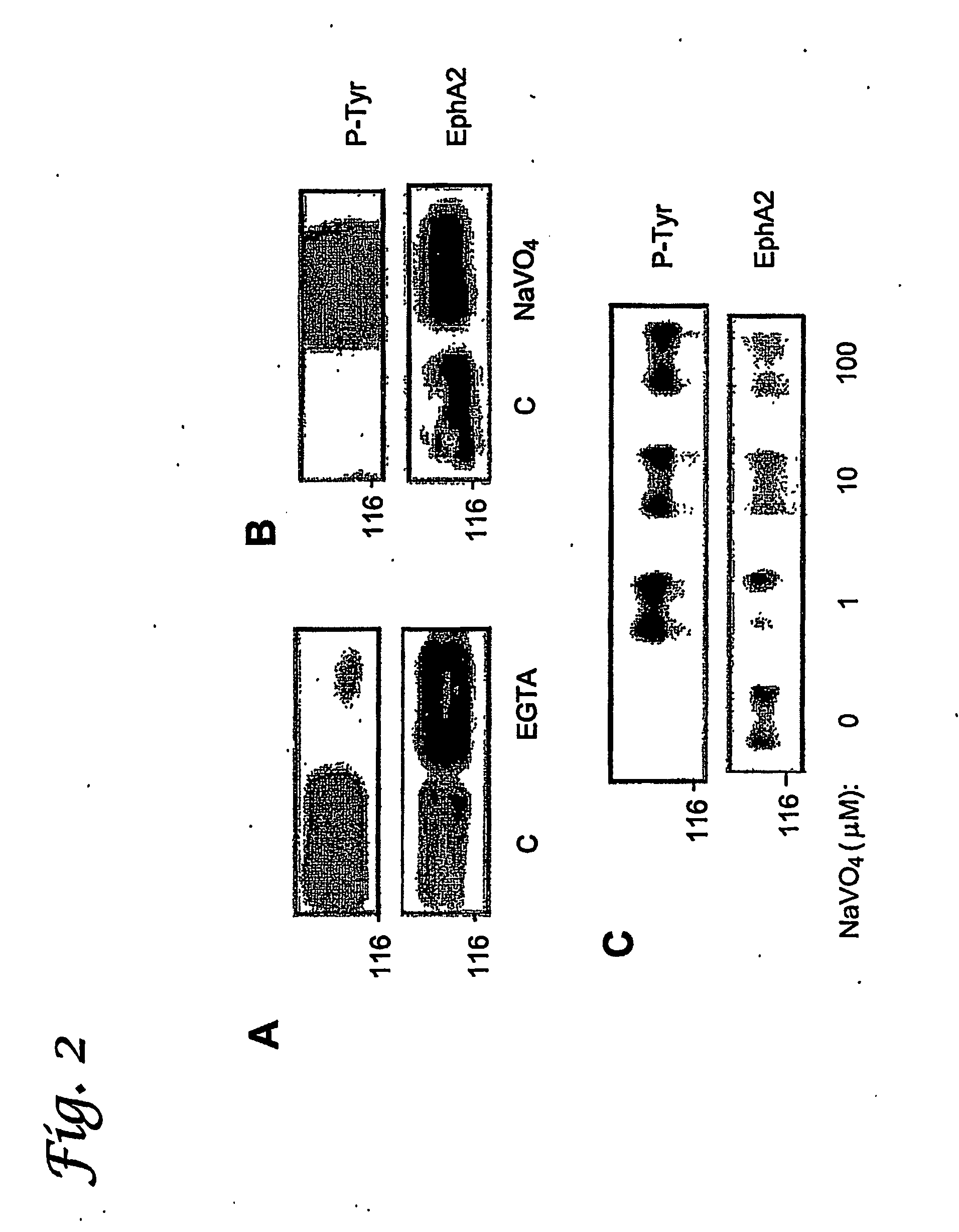 Low molecular weight protein tyrosine phosphatase (lmw-ptp) as a diagnostic and therapeutic target