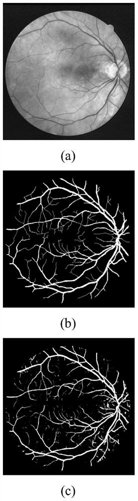 Vessel Segmentation Method of Fundus Image Based on Multi-scale Features of Fully Convolutional Neural Network