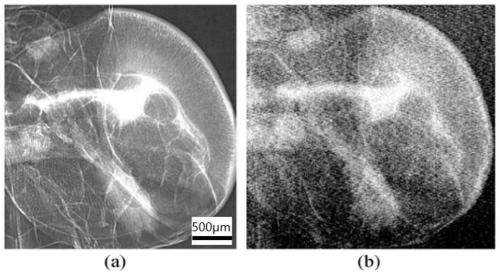 High-energy X-ray CT device based on phase contrast imaging and imaging method