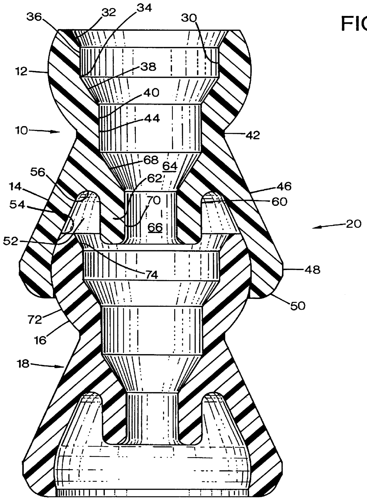 Ball and socket joint with internal stop