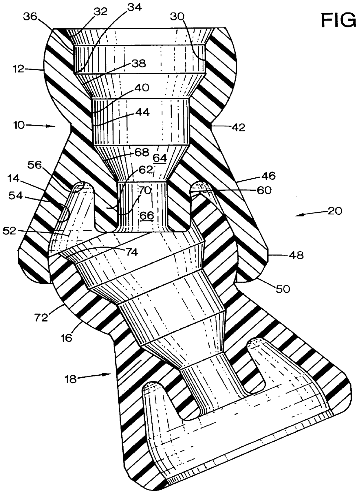 Ball and socket joint with internal stop