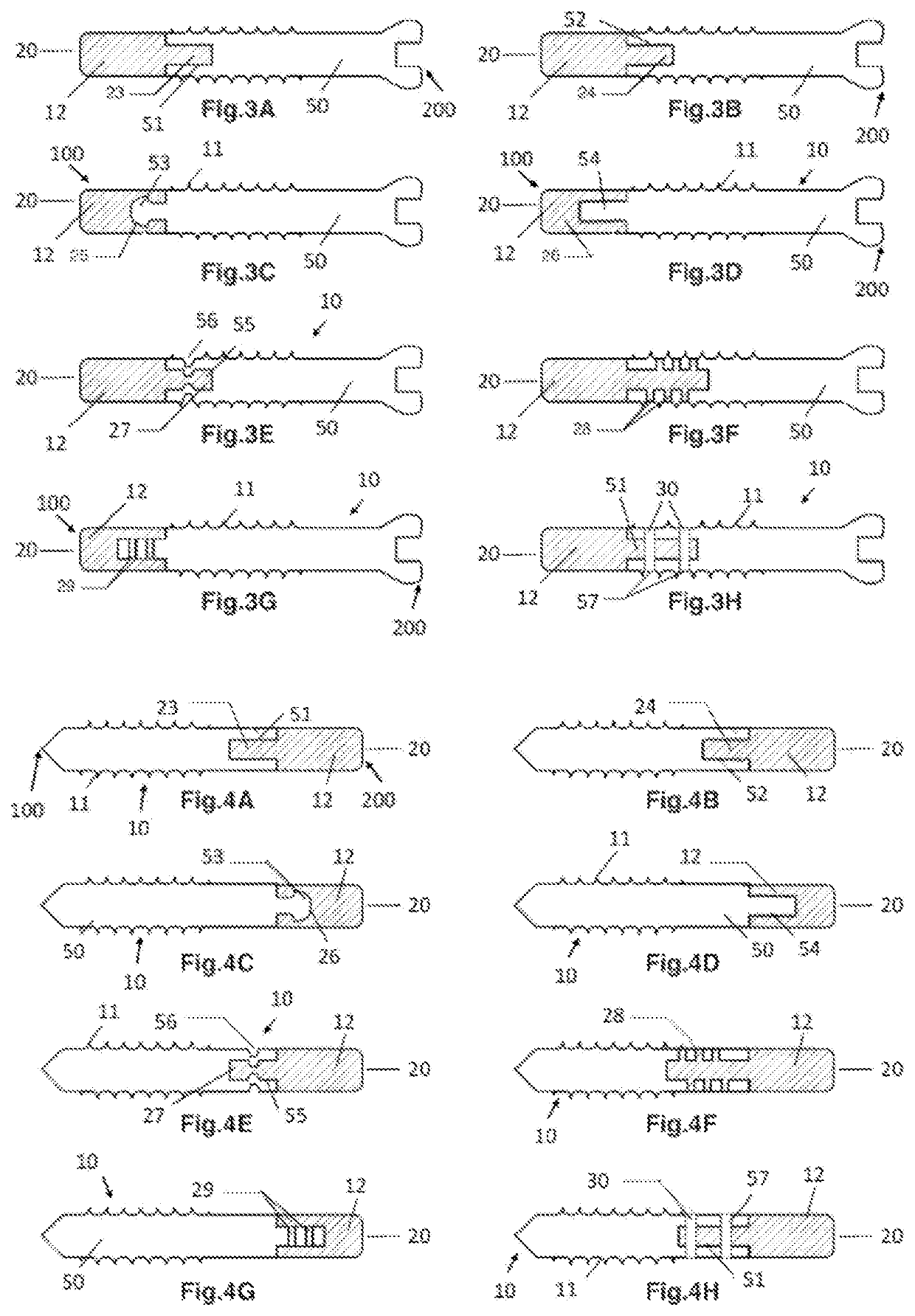 Anti-penetration bone implant device and method