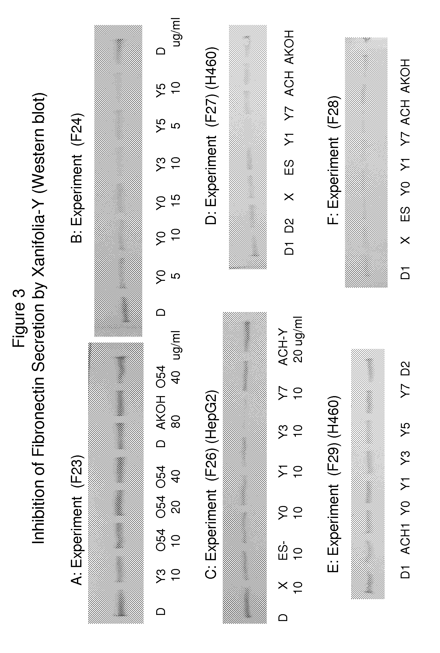 Blocking the migration or metastasis of cancer cells by affecting adhesion proteins and the uses of new compounds thereof