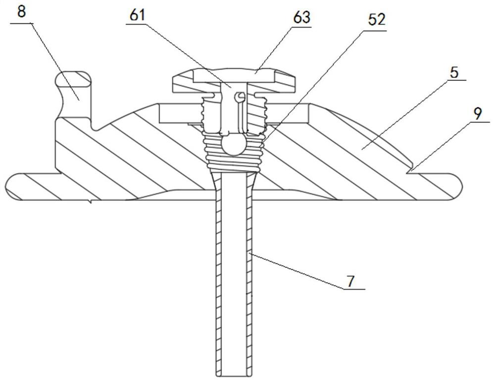 Heart valve replacement prosthesis and threaded fastening heart apex pad thereof