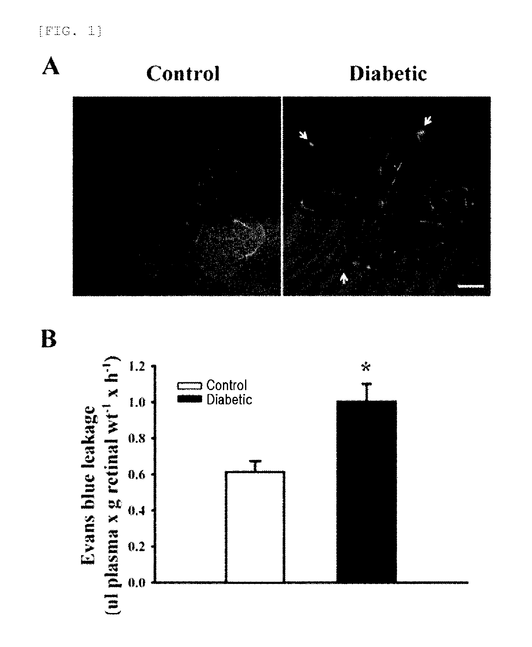 Recombinant adenovirus expressing alpha-a-crystallin gene and gene therapy for retinalvascular disease using the same